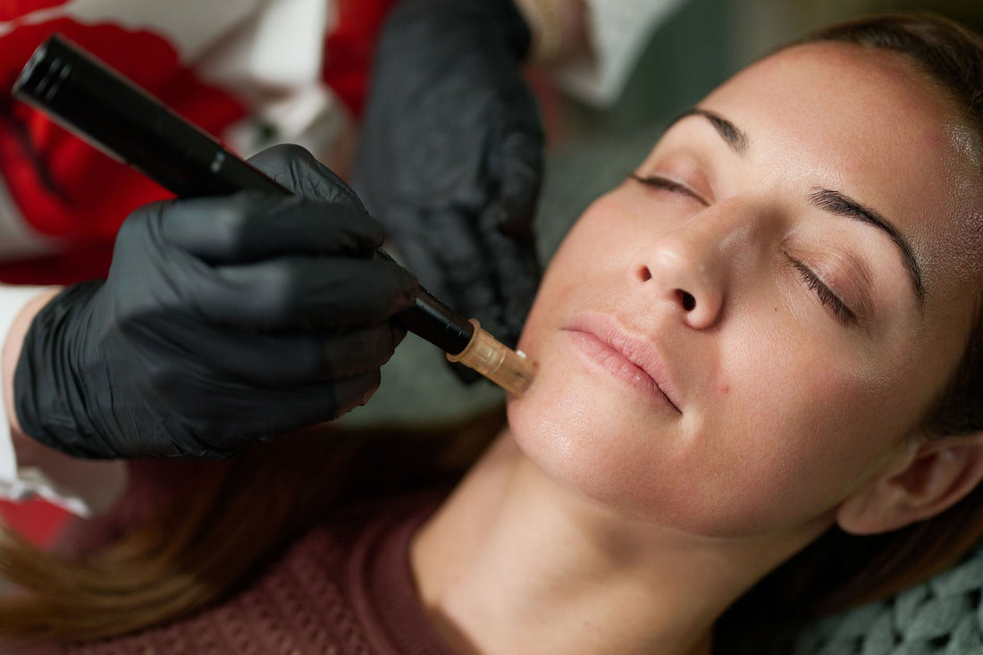 Microneedling